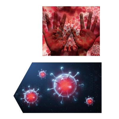 Płyn do dezynfekcji rąk dłoni skóry 1l Sterillhand + pompka Alpinus